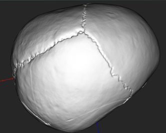 Skull Medium Top.png