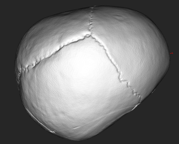 Skull No Noise Reduction.png