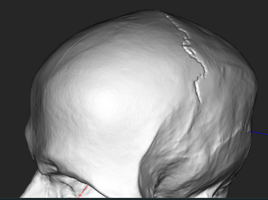 Skull Medium Side.png