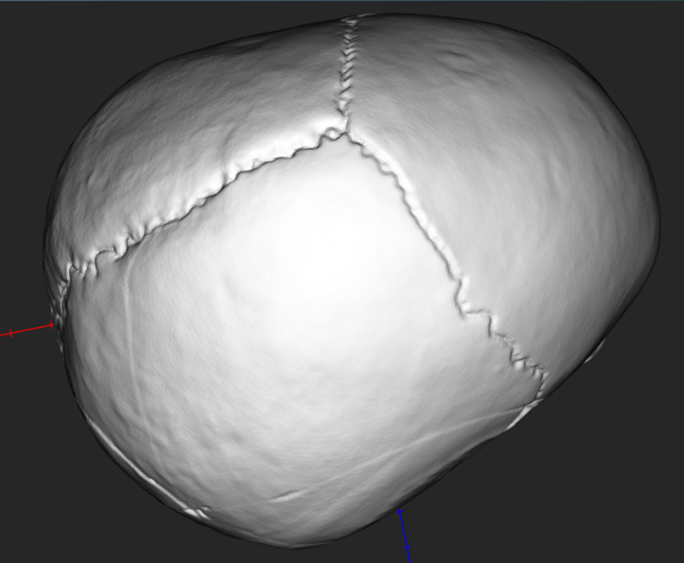 Skull Noise Reduction.png